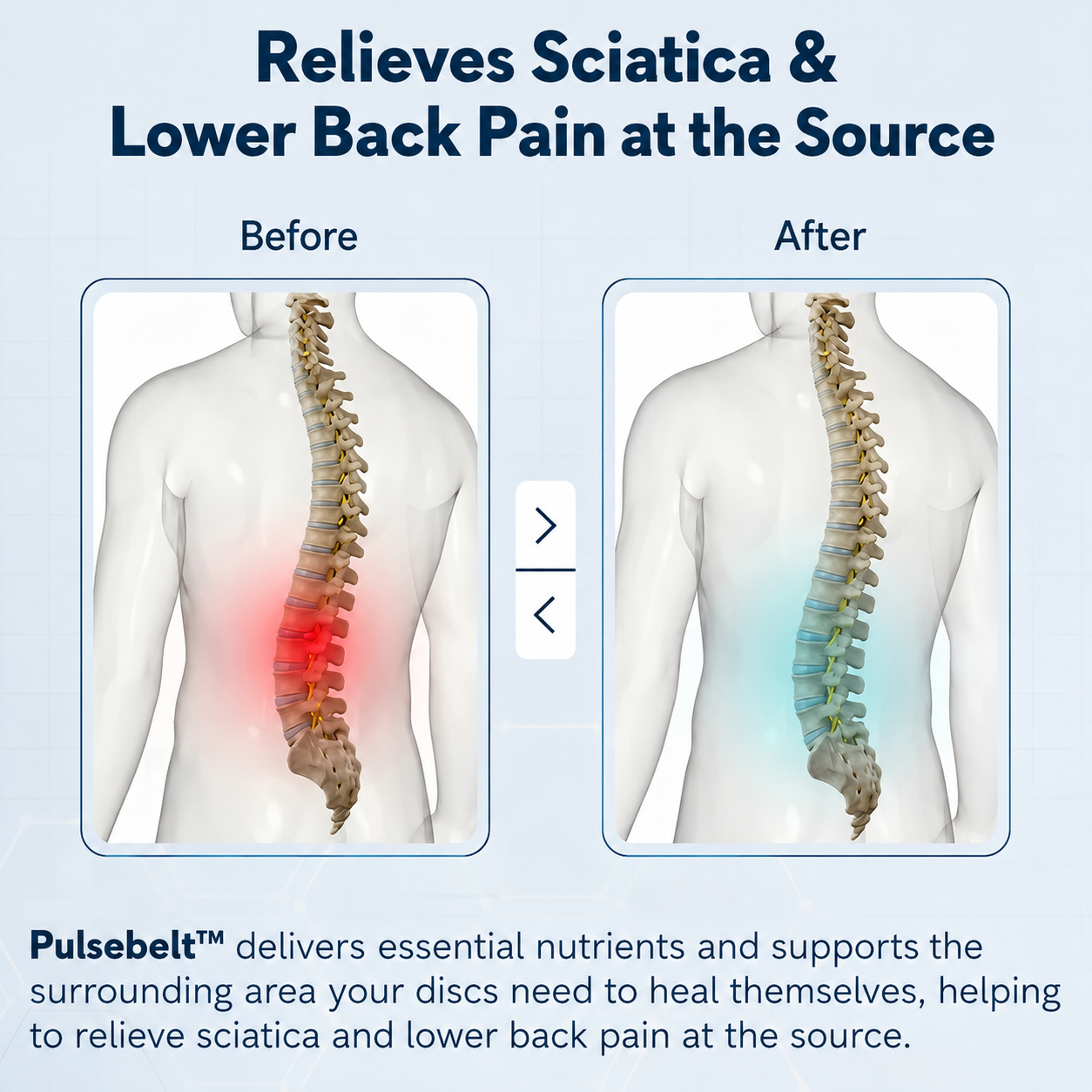 Pulse Belt™ | Sciatica & Spinal Stenosis Relief